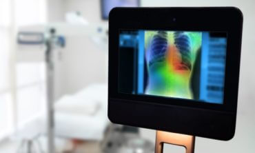 Imagem de Estudo usa Inteligência Artificial para detecção de nódulos cancerígenos
